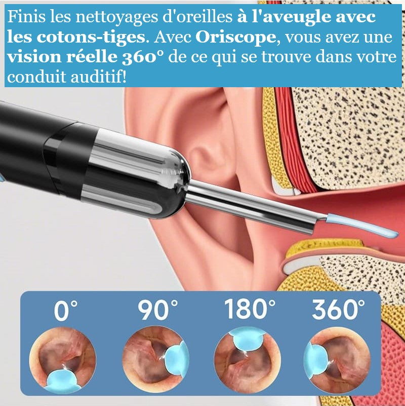 ORISCOPE - Nettoyeur d'Oreille Intelligent